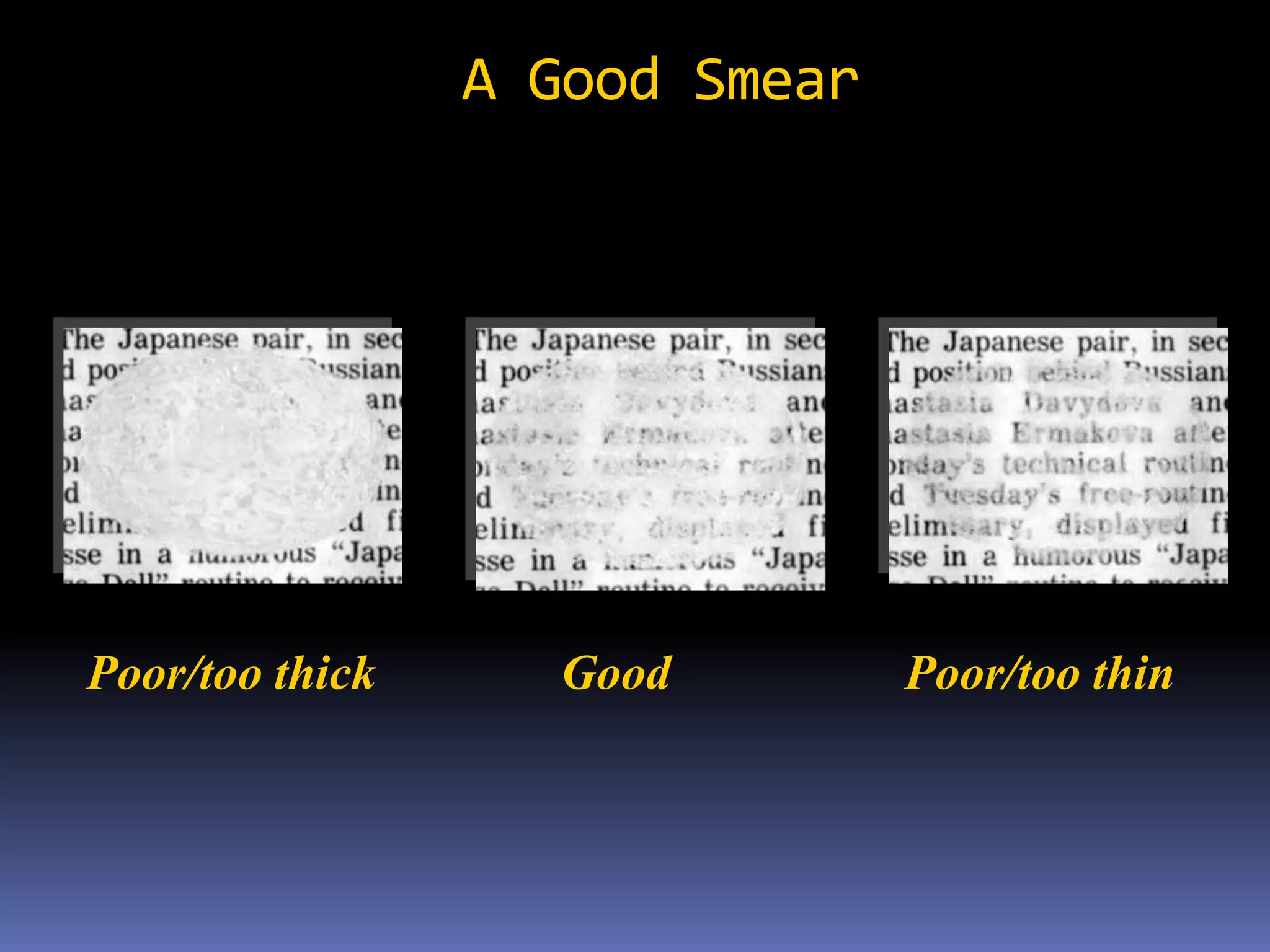 Rex Karl S. Teoxon, R.N, M.D79MANAGEMENTFollow-up     * 2 wks after medications – non communicable	  3 successive (-) sputum - non communicablerifampicin - prophylactic