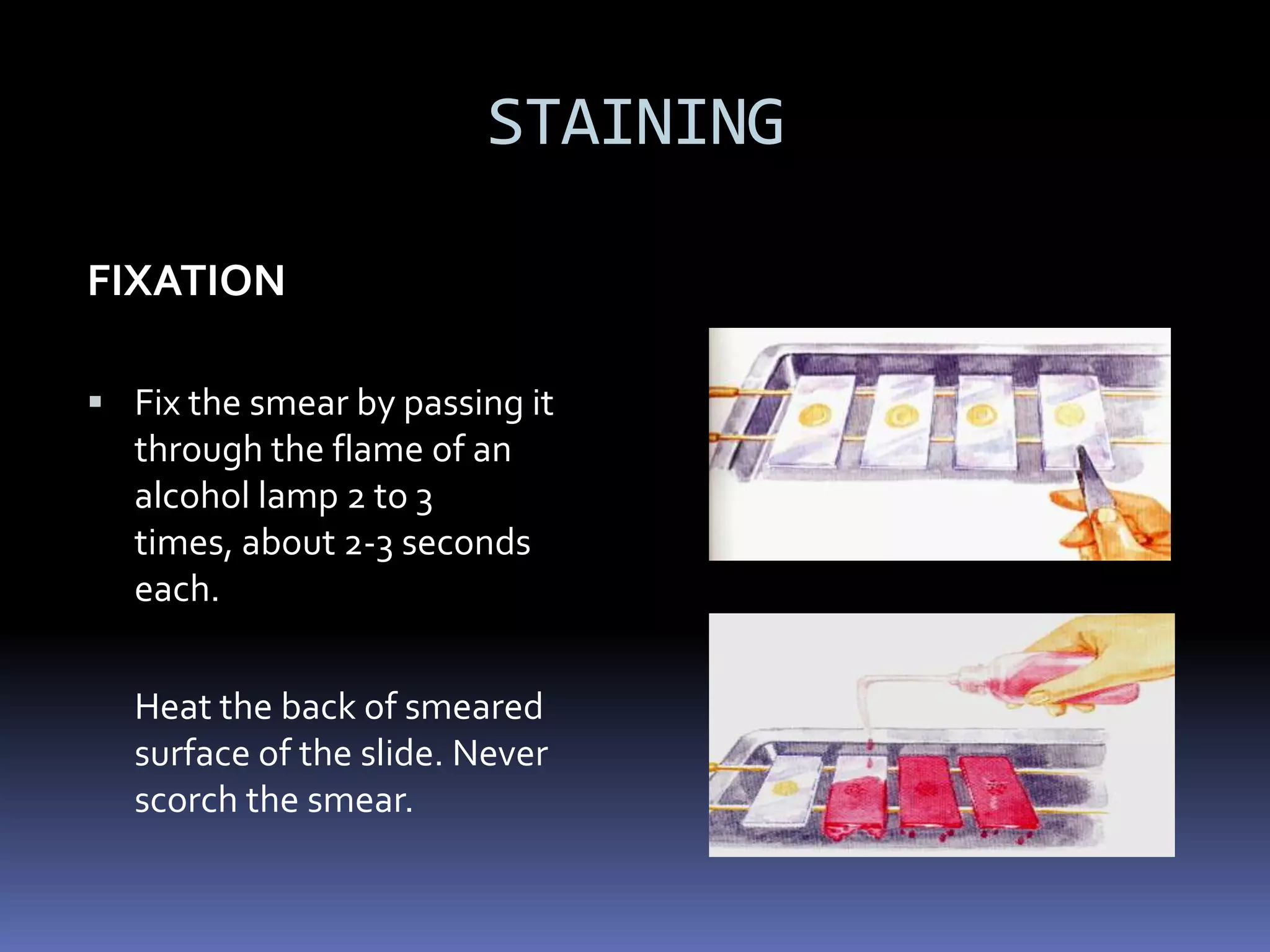Rex Karl S. Teoxon, R.N, M.D82MDT side effectsr-orange urinei-neuritis and hepatitisp-hyperuricemiae-impairment of visions-8th cranial nerve damage
