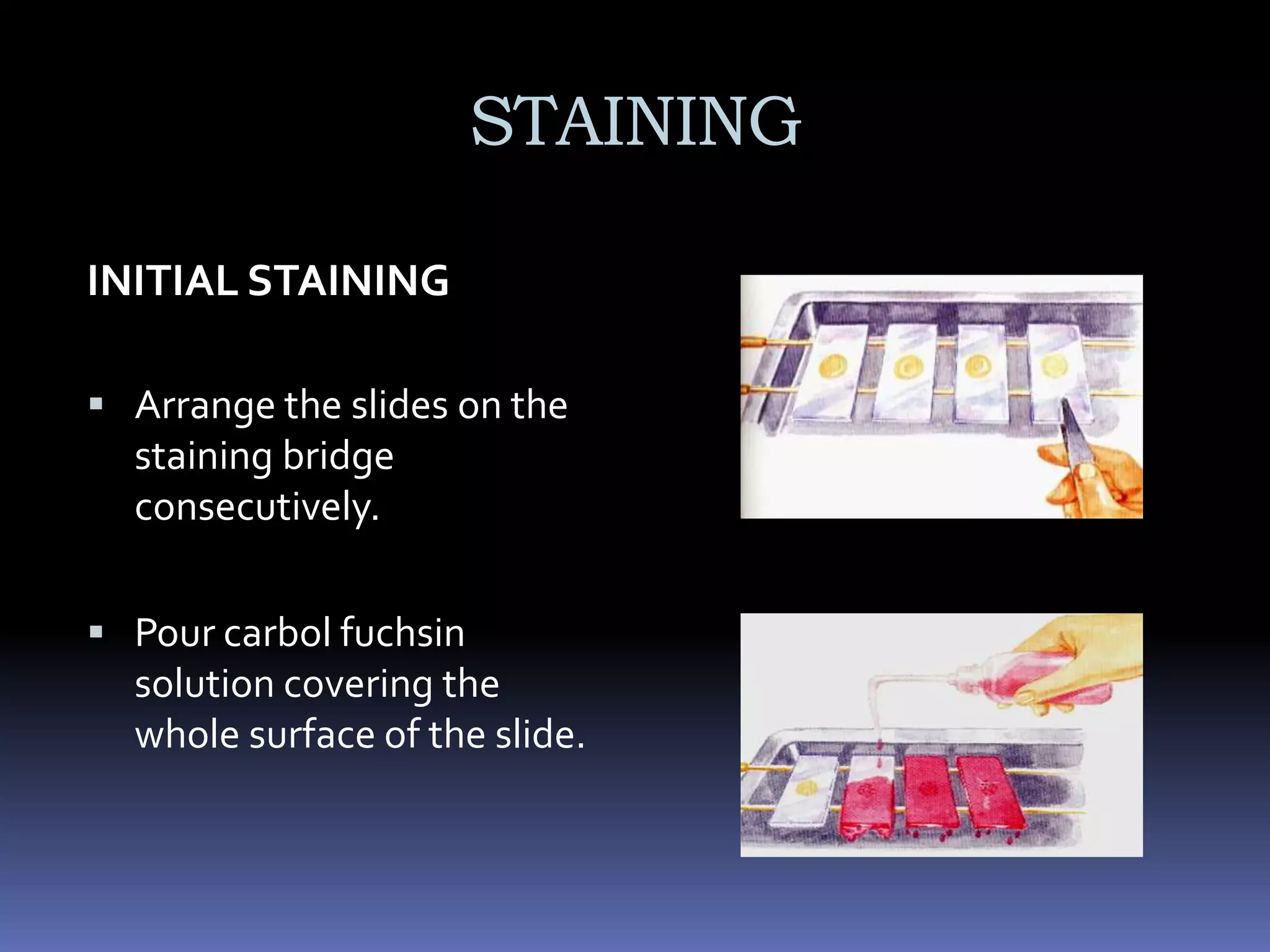 AFB SMEAR REPORTING GUIDELINE, DOHNATIONAL TUBERCULOSIS CONTROL PROGRAM (2001)Emilio M. Ramirez, MD