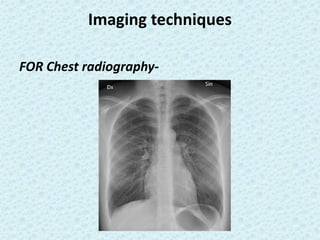 Chest Physical Instrument Instruments Used for respiratory disease diagnosis | PPTX