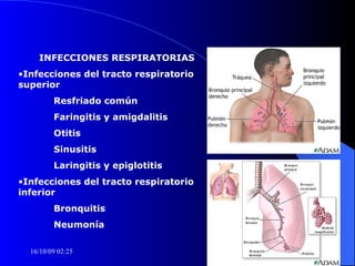 INFECCIONES RESPIRATORIAS Infecciones del tracto respiratorio superior Resfriado común Faringitis y amigdalitis Otitis Sinusitis Laringitis y epiglotitis Infecciones del tracto respiratorio inferior Bronquitis  Neumonía 