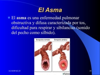 El Asma El  asma  es una enfermedad pulmonar obstructiva y difusa caracterizada por tos, dificultad para respirar y sibilancias (sonido del pecho como silbido).  