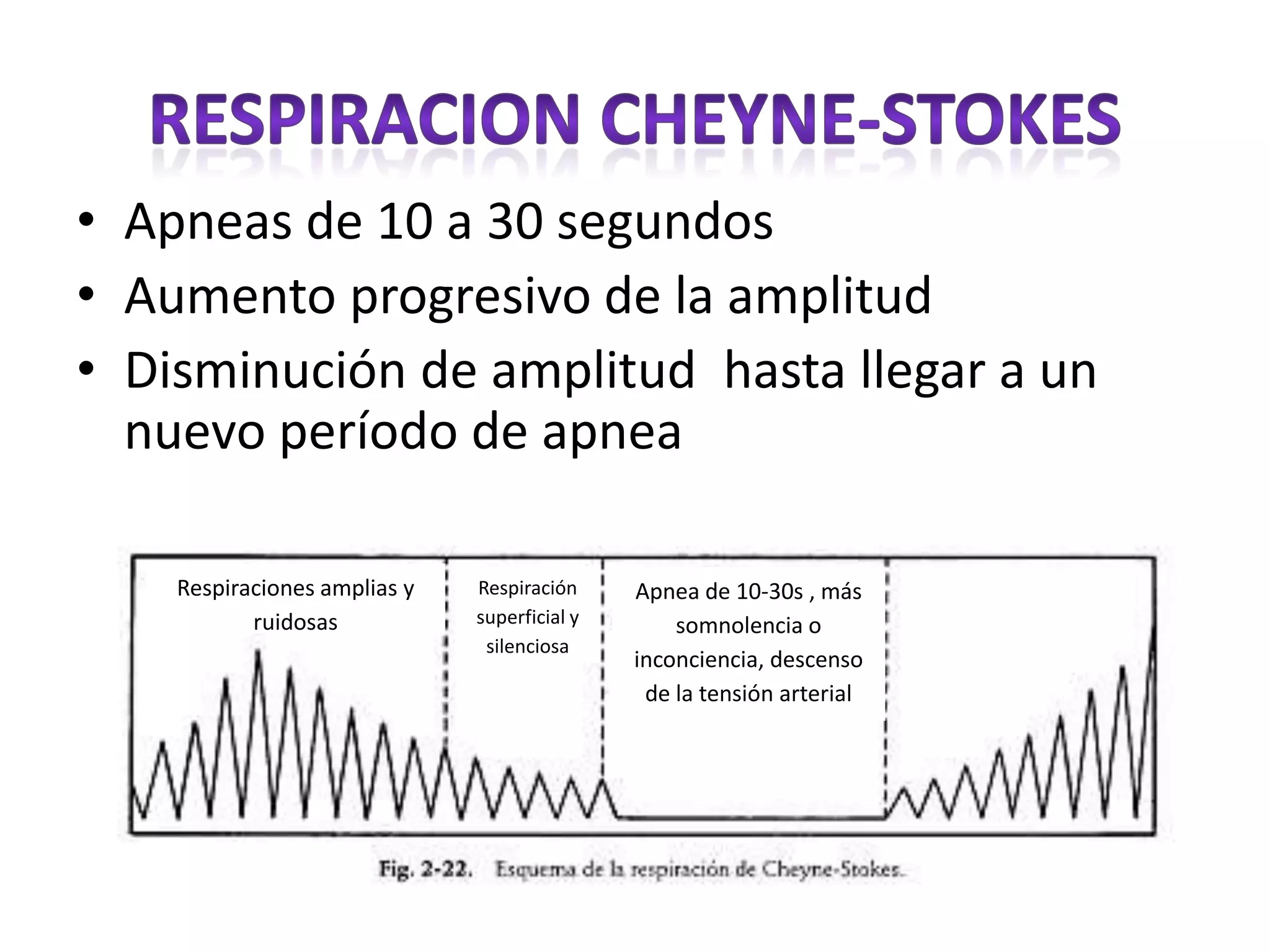 Respiracion cheyne stokes PPT