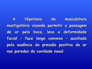 A Hipotonia da musculaturaA Hipotonia da musculatura
mastigatória visando permitir a passagemmastigatória visando permitir a passagem
de ar pela boca, leva a deformidadede ar pela boca, leva a deformidade
facial – face longo convexa – auxiliadafacial – face longo convexa – auxiliada
pela ausência da pressão positiva do arpela ausência da pressão positiva do ar
nas paredes da cavidade nasal.nas paredes da cavidade nasal.
 