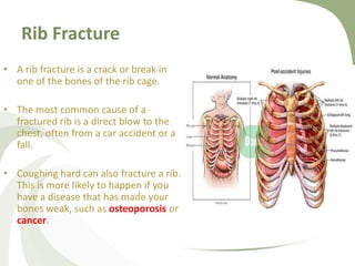 Rib Crake Respiration | PPTX