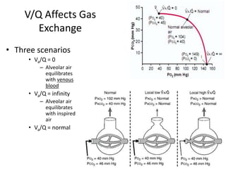 V/Q Affects Gas ExchangeThree scenariosVa/Q = 0Alveolar air equilibrates with venous bloodVa/Q = infinityAlveolar air equilibrates with inspired airVa/Q = normal