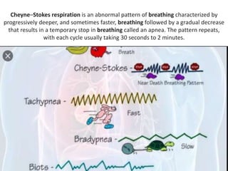 Cheyne–Stokes respiration is an abnormal pattern of breathing characterized by
progressively deeper, and sometimes faster, breathing followed by a gradual decrease
that results in a temporary stop in breathing called an apnea. The pattern repeats,
with each cycle usually taking 30 seconds to 2 minutes.
 