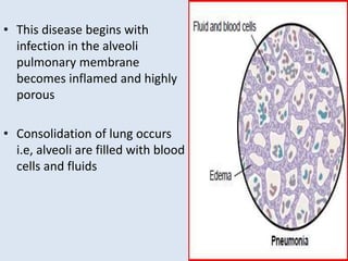• This disease begins with
infection in the alveoli
pulmonary membrane
becomes inflamed and highly
porous
• Consolidation of lung occurs
i.e, alveoli are filled with blood
cells and fluids
 