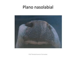 Plano nasolabial
Profª Renata Avancini Fernandes
 