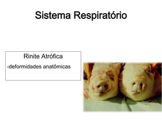 Sistema Respiratório
Rinite Atrófica
-deformidades anatômicas
 