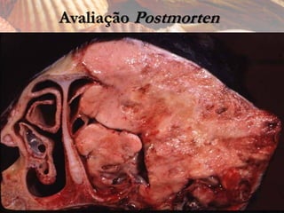 Avaliação Postmorten
 