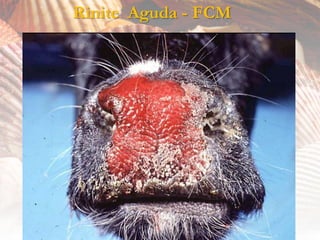 Rinite Aguda - FCM
 