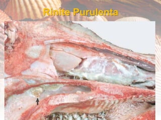 Rinite Purulenta
 