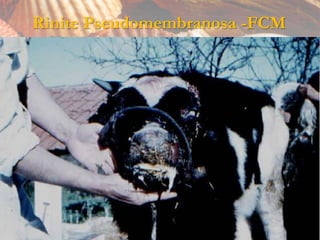Rinite Pseudomembranosa -FCM
 
