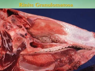 Rinite Granulomatosa
 