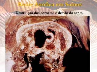 Rinite Atrófica em Suínos
Destruição dos cornetos e desvio do septo
 