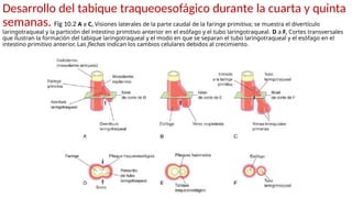 Desarrollo del tabique traqueoesofágico durante la cuarta y quinta
semanas. Fig 10.2 A a C, Visiones laterales de la parte caudal de la faringe primitiva; se muestra el divertículo
laringotraqueal y la partición del intestino primitivo anterior en el esófago y el tubo laringotraqueal. D a F, Cortes transversales
que ilustran la formación del tabique laringotraqueal y el modo en que se separan el tubo laringotraqueal y el esófago en el
intestino primitivo anterior. Las flechas indican los cambios celulares debidos al crecimiento.
 