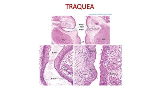 TRAQUEA
 