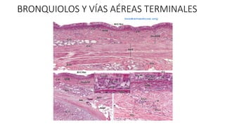 BRONQUIOLOS Y VÍAS AÉREAS TERMINALES
 