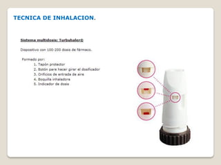 TECNICA DE INHALACION.
 