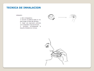 TECNICA DE INHALACION
 
