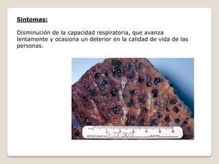 Sintomas:
Disminución de la capacidad respiratoria, que avanza
lentamente y ocasiona un deterior en la calidad de vida de las
personas.
 