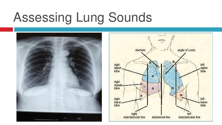 Respiratory