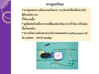 การดูแลรักษา
• การดูดเสมหะหลังเจาะคอวันแรก : ควรทาเท่ าที่จาเป็ นสาหรับ
ผู้ป่วยแต่ ละราย
•ให้ ความชื้น
• ผูกยึดท่ อด้ วยเชือก ควรเปลียนอย่ างน้ อย 8-12 ชั่วโมง หรือบ่ อย
่
ขึนถ้ าสกปรก
้
• ตรวจวัดความดันของกระเปาะหลอดลมคอ (cuff pressure) 2530 cmH2O (20-25 mmHg)

 