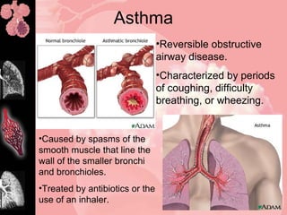 Asthma
•Reversible obstructive
airway disease.
•Characterized by periods
of coughing, difficulty
breathing, or wheezing.
•Caused by spasms of the
smooth muscle that line the
wall of the smaller bronchi
and bronchioles.
•Treated by antibiotics or the
use of an inhaler.
 