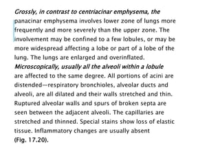 Grossly, in contrast to centriacinar emphysema, the
panacinar emphysema involves lower zone of lungs more
frequently and more severely than the upper zone. The
involvement may be confined to a few lobules, or may be
more widespread affecting a lobe or part of a lobe of the
lung. The lungs are enlarged and overinflated.
Microscopically, usually all the alveoli within a lobule
are affected to the same degree. All portions of acini are
distended—respiratory bronchioles, alveolar ducts and
alveoli, are all dilated and their walls stretched and thin.
Ruptured alveolar walls and spurs of broken septa are
seen between the adjacent alveoli. The capillaries are
stretched and thinned. Special stains show loss of elastic
tissue. Inflammatory changes are usually absent
(Fig. 17.20).
 