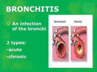 Respiratory-and-Circulatory-Diseases.ppt