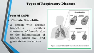 Types of COPD
a. Chronic Bronchitis
- A person with chronic
bronchitis exhibits
shortness of breath due
to the inflammation of
bronchi which swell and
generate excess mucus.
Types of Respiratory Diseases
 