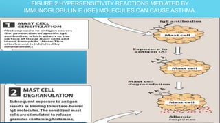FIGURE.2 HYPERSENSITIVITY REACTIONS MEDIATED BY
IMMUNOGLOBULIN E (IGE) MOLECULES CAN CAUSE ASTHMA.
 