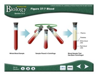 Go to
Section:
Section 37-2
Figure 37-7 Blood
Whole Blood Sample
Red blood
cells
White blood
cells
Platelets
Plasma
Sample Placed in Centrifuge Blood Sample That
Has Been Centrifuged
 