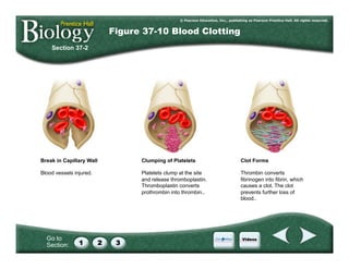 Go to
Section:
Section 37-2
Figure 37-10 Blood Clotting
Break in Capillary Wall
Blood vessels injured.
Clumping of Platelets
Platelets clump at the site
and release thromboplastin.
Thromboplastin converts
prothrombin into thrombin..
Clot Forms
Thrombin converts
fibrinogen into fibrin, which
causes a clot. The clot
prevents further loss of
blood..
 