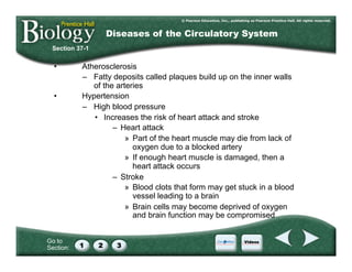 Go to
Section:
•  Atherosclerosis
–  Fatty deposits called plaques build up on the inner walls
of the arteries
•  Hypertension
–  High blood pressure
•  Increases the risk of heart attack and stroke
–  Heart attack
»  Part of the heart muscle may die from lack of
oxygen due to a blocked artery
»  If enough heart muscle is damaged, then a
heart attack occurs
–  Stroke
»  Blood clots that form may get stuck in a blood
vessel leading to a brain
»  Brain cells may become deprived of oxygen
and brain function may be compromised
Section 37-1
Diseases of the Circulatory System
 