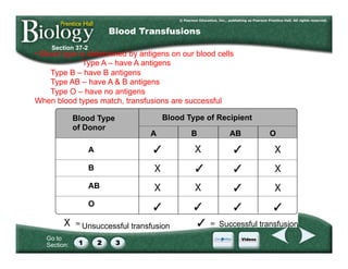 Go to
Section:
Blood Type
of Donor
A
B
AB
O
Blood Type of Recipient
A B AB O
Unsuccessful transfusion Successful transfusion
Section 37-2
Blood Transfusions
• Blood type is determined by antigens on our blood cells
Type A – have A antigens
Type B – have B antigens
Type AB – have A & B antigens
Type O – have no antigens
When blood types match, transfusions are successful
 