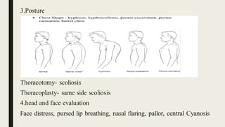 3.Posture
Thoracotomy- scoliosis
Thoracoplasty- same side scoliosis
4.head and face evaluation
Face distress, pursed lip breathing, nasal flaring, pallor, central Cyanosis
 