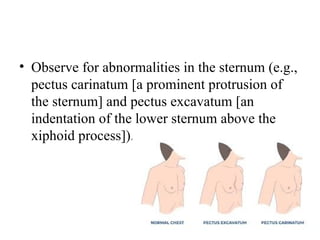 Prominent Pectus Unit IV. Assessment of respiratory system.pptx