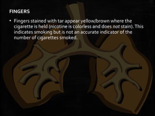FINGERS
▪ Fingers stained with tar appear yellow/brown where the
cigarette is held (nicotine is colorless and does not stain).This
indicates smoking but is not an accurate indicator of the
number of cigarettes smoked.
 