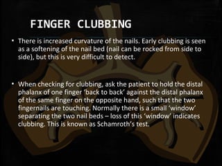 FINGER CLUBBING
▪ There is increased curvature of the nails. Early clubbing is seen
as a softening of the nail bed (nail can be rocked from side to
side), but this is very difficult to detect.
▪ When checking for clubbing, ask the patient to hold the distal
phalanx of one finger ‘back to back’ against the distal phalanx
of the same finger on the opposite hand, such that the two
fingernails are touching. Normally there is a small ‘window’
separating the two nail beds – loss of this ‘window’ indicates
clubbing. This is known as Schamroth’s test.
 