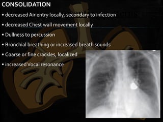 Important presenting patterns
CONSOLIDATION
• decreased Air entry locally, secondary to infection
• decreased Chest wall movement locally
• Dullness to percussion
• Bronchial breathing or increased breath sounds
• Coarse or fine crackles, localized
• increasedVocal resonance
 