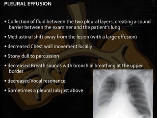 PLEURAL EFFUSION
• Collection of fluid between the two pleural layers, creating a sound
barrier between the examiner and the patient’s lung
• Mediastinal shift away from the lesion (with a large effusion)
• decreased Chest wall movement locally
• Stony dull to percussion
• decreased Breath sounds with bronchial breathing at the upper
border
• decreasedVocal resonance
• Sometimes a pleural rub just above
 