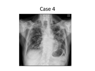 Case 4
 