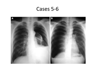 Cases 5-6
 