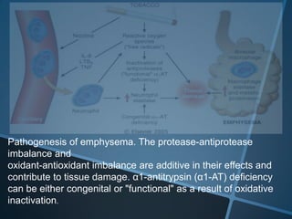 Pathogenesis of emphysema. The protease-antiprotease
imbalance and
oxidant-antioxidant imbalance are additive in their effects and
contribute to tissue damage. α1-antitrypsin (α1-AT) deficiency
can be either congenital or "functional" as a result of oxidative
inactivation.
 