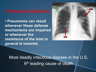 Pulmonary Infections

• Pneumonia can result
whenever these defense
mechanisms are impaired
or whenever the
resistance of the host in
general is lowered.


• Most deadly infectious disease in the U.S.
       • 6th leading cause of death
 
