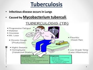 Tuberculosis
• Infectious disease occurs in Lungs
• Caused by Mycobacterium tuberculi.
 