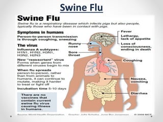 Swine Flu
 