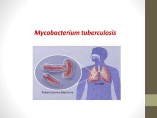 Mycobacterium tuberculosis
 
